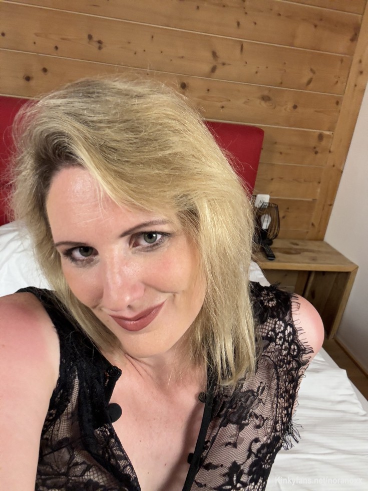 Noch jemand Sonnenbrand?